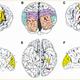 Image for article titled Einstein's brain was definitely not like the others, scientists say